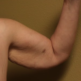 Before arm lift left arm