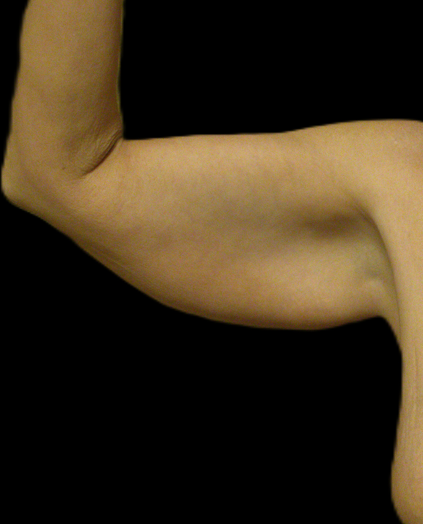 Before arm lift right arm