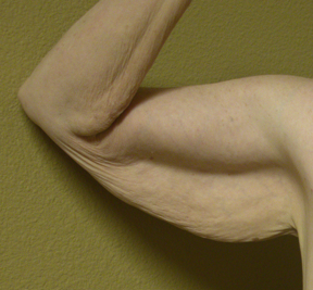 Before arm lift right arm